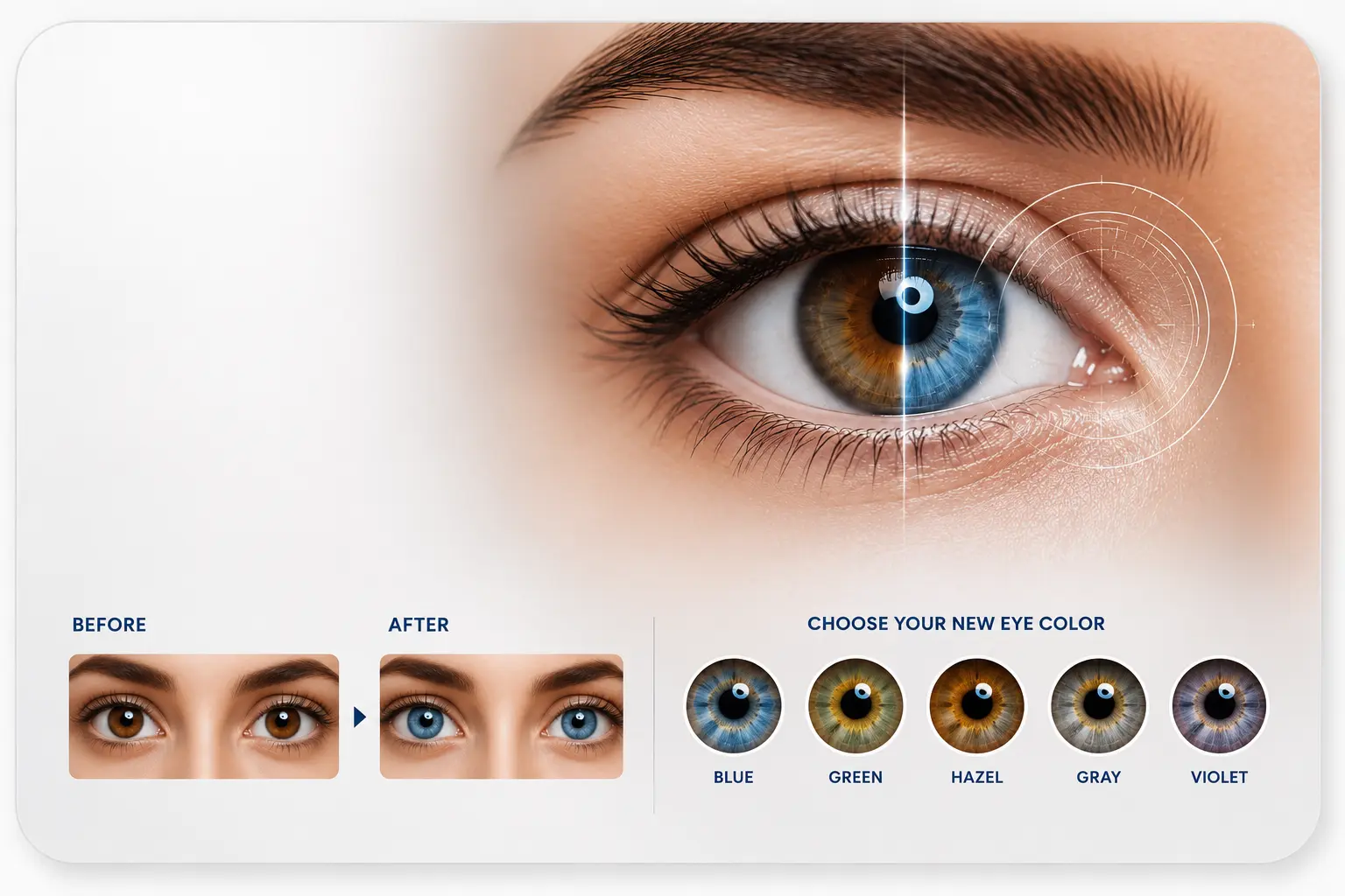 Eye colour change and keratopigmentation treatment options